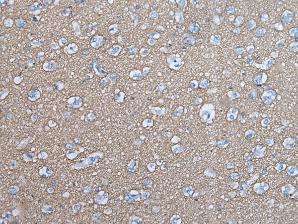 Immunohistochemistry of paraffin-embedded Human brain tissue  using SNCB Polyclonal Antibody at dilution of 1:45(?200)