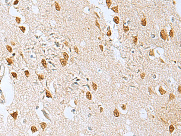 Immunohistochemistry of paraffin-embedded Human brain tissue  using KDM2B Polyclonal Antibody at dilution of 1:50(?200)