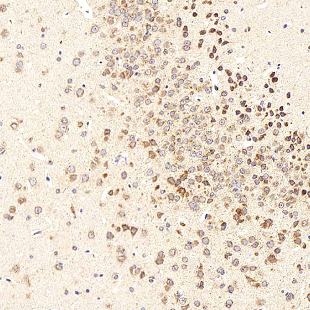 Immunohistochemistry analysis of paraffin-embedded mouse brain  using beta Amyloid Polyclonal Antibody at dilution of 1:300.