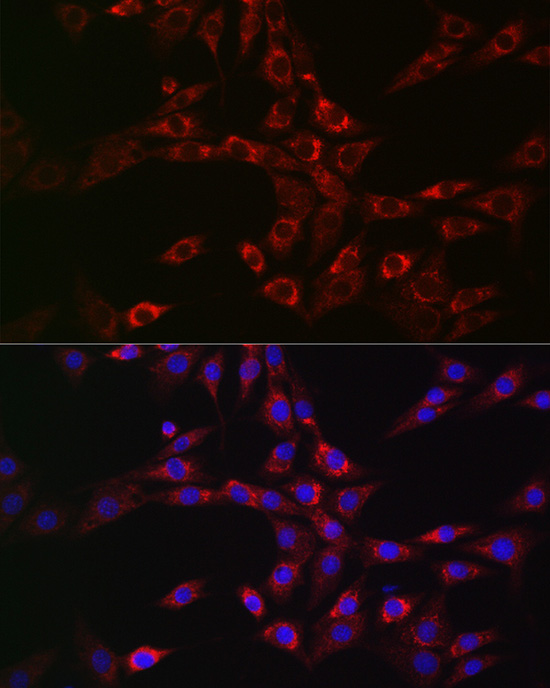 Immunofluorescence analysis of NIH/3T3 cells using CHMP6 Polyclonal Antibody at dilution of 1:100 (40x lens). Blue: DAPI for nuclear staining.