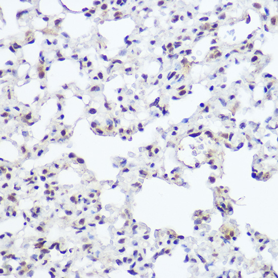 Immunohistochemistry of paraffin-embedded rat lung using NFIB Polyclonal Antibody at dilution of 1:200 (40x lens).Perform high pressure antigen retrieval with 10 mM citrate buffer pH 6.0 before commencing with IHC staining protocol.