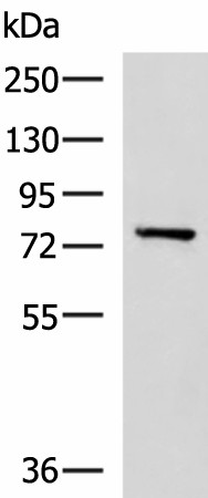 Western blot analysis of Mouse brain tissue lysate  using CAPN5 Polyclonal Antibody at dilution of 1:550