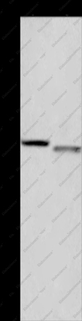 FRK Polyclonal Antibody - 1
