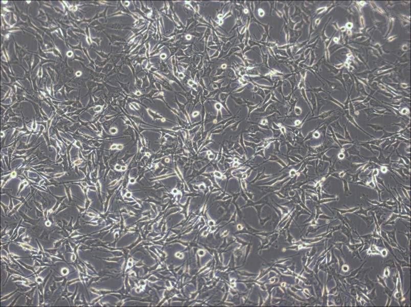 U-87 MG-LUC Cell Complete Medium - 6