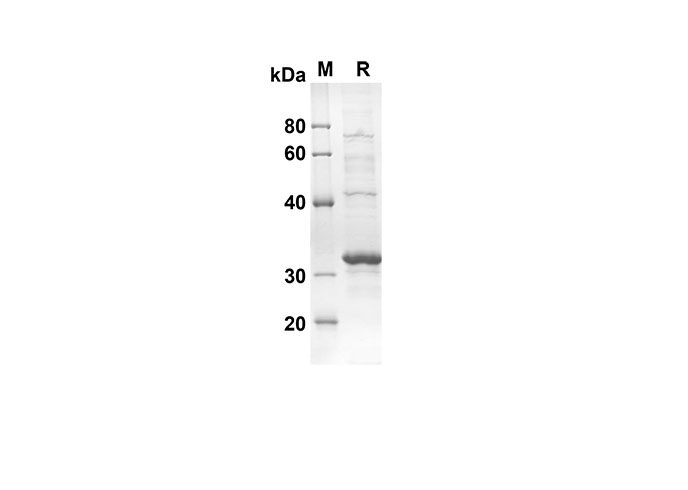 Recombinant Mouse RETN Protein(Trx Tag)-1