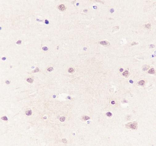 Recombinant CSNK2A1 Monoclonal Antibody - small - 3