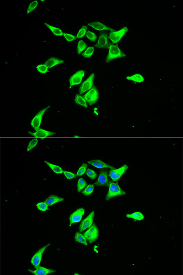 Immunofluorescence analysis of A549 cells using CD55 Polyclonal Antibody