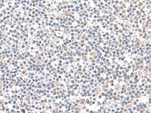 Immunohistochemistry of paraffin-embedded Human tonsil tissue  using IFI27 Polyclonal Antibody at dilution of 1:100(?200)