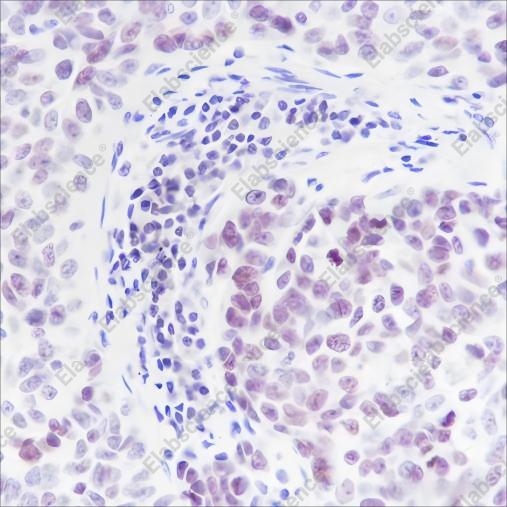 Recombinant ING5 Monoclonal Antibody - 3