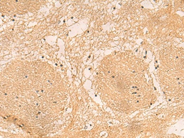 Immunohistochemistry of paraffin-embedded Human brain tissue  using EMC1 Polyclonal Antibody at dilution of 1:40(?200)