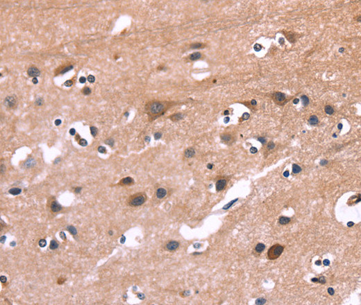 Immunohistochemistry of paraffin-embedded Human brain tissue using PIP5K1B Polyclonal Antibody at dilution 1:30