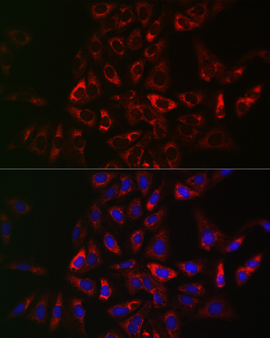 Immunofluorescence analysis of U2OS cells using TRAF3IP2 Polyclonal antibody at dilution of 1:50 (40x lens). Blue: DAPI for nuclear staining.