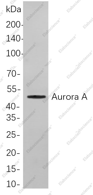 Recombinant Aurora A Monoclonal Antibody - 1