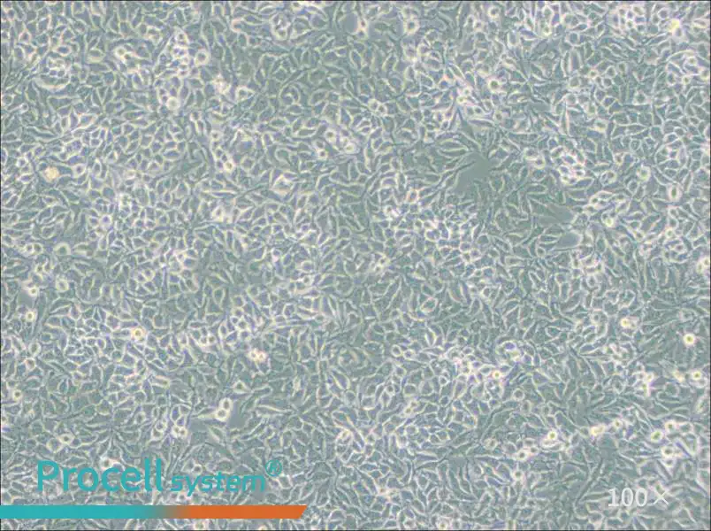 NCI-H3122 Cell Complete Medium - 1