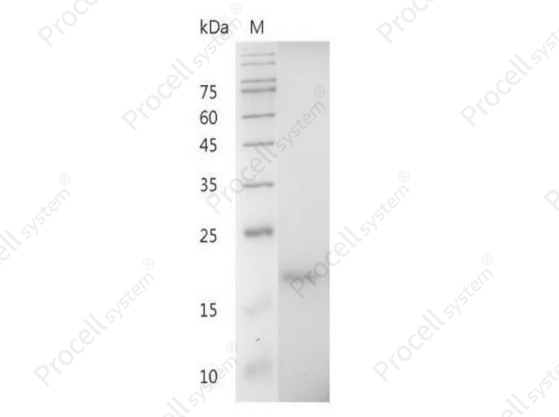 CXCL12/SDF-1, Mouse, Recombinant