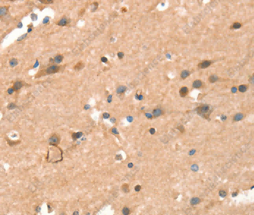 CRELD1 Polyclonal Antibody - 3