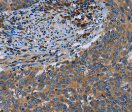 HYAL3 Polyclonal Antibody - 2