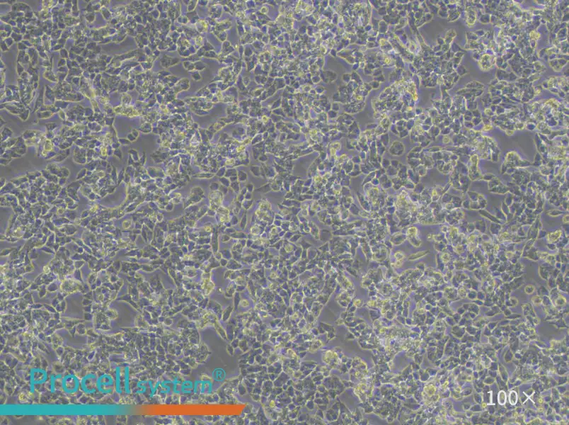 A2780 Cell Complete Medium - 3