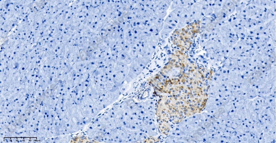 Recombinant Chromogranin A Monoclonal Antibody - 4