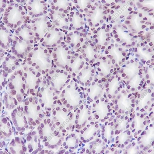 Recombinant HMGB1 Monoclonal Antibody - 3