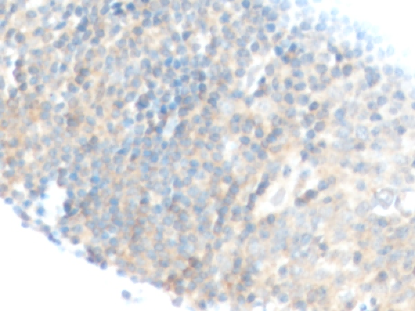 RGS1 Polyclonal Antibody - 2