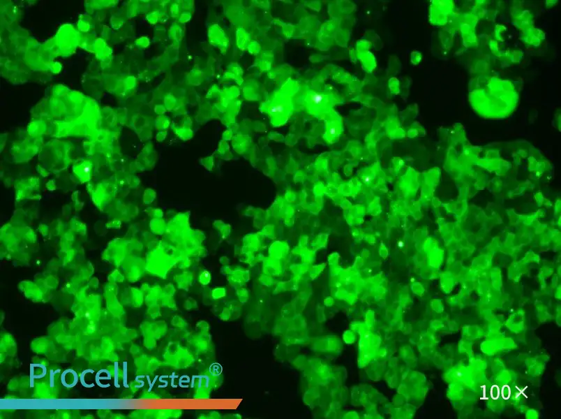 MCF-7-GFP Cell Complete Medium - 3