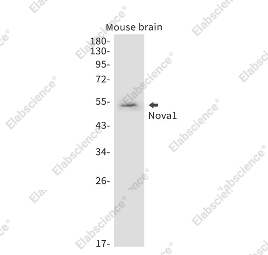 Recombinant Nova1 Monoclonal Antibody - 1