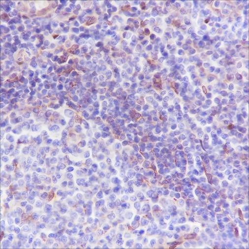 Recombinant VISTA Monoclonal Antibody - small - 2