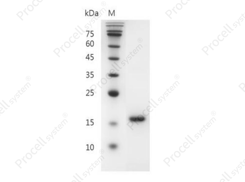 Flt-3 Ligand/FL/FLG3L/FLT3L, Mouse, Recombinant