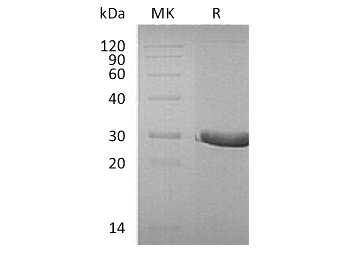 Recombinant Human DTD1 Protein (His Tag)