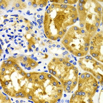 Immunohistochemistry of paraffin-embedded Human kidney using CDK20 Polyclonal Antibody at dilution of 1:100 (40x lens).