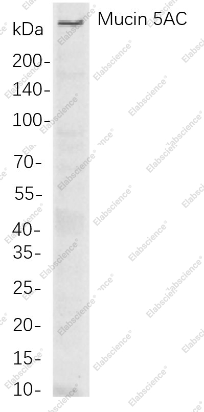 Recombinant Mucin 5AC Monoclonal Antibody - 1