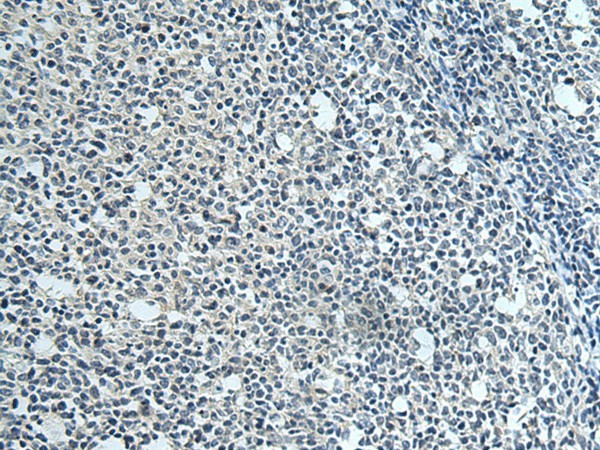 Immunohistochemistry of paraffin-embedded Human tonsil tissue  using SLC35F6 Polyclonal Antibody at dilution of 1:115(?200)