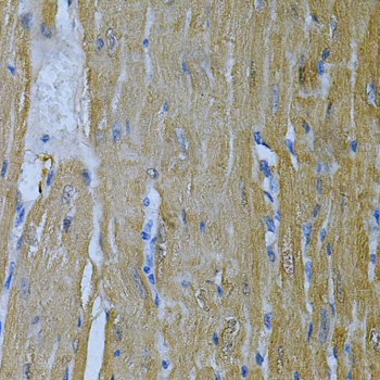 Immunohistochemistry of paraffin-embedded mouse heart using AK1 Polyclonal antibody at dilution of 1:100 (40x lens).Perform microwave antigen retrieval with 10 mM PBS buffer pH 7.2 before commencing with IHC staining protocol.