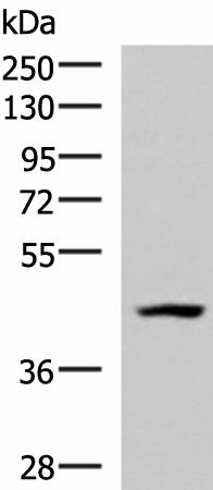 Western blot analysis of 293T cell lysate  using MAGEC2 Polyclonal Antibody at dilution of 1:700