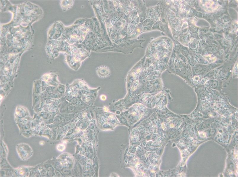 MDA-MB-175VII (L15) Cell Complete Medium - small - 4