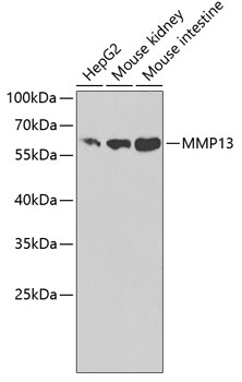 Western blot analysis of extracts of various cell lines using MMP13 Polyclonal Antibody at dilution of 1:1000.