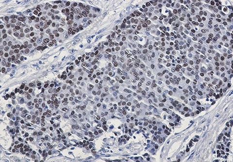 Recombinant Phospho-GATA3 (Ser308) Monoclonal Antibody - 2