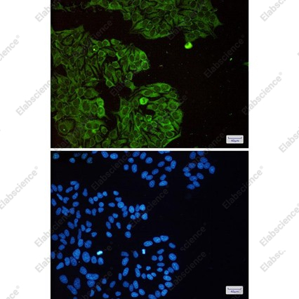Recombinant eIF3B Monoclonal Antibody - 2