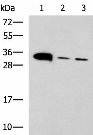 Western blot analysis of Mouse heart tissue Mouse stomach tissue and PC-3 cell lysates  using PSCA Polyclonal Antibody at dilution of 1:650