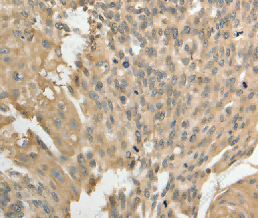 GSR Polyclonal Antibody - 2
