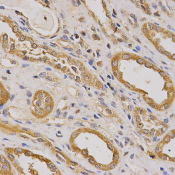 Immunohistochemistry of paraffin-embedded Human kidney using ARHGAP25 Polyclonal Antibody at dilution of 1:200 (40x lens).