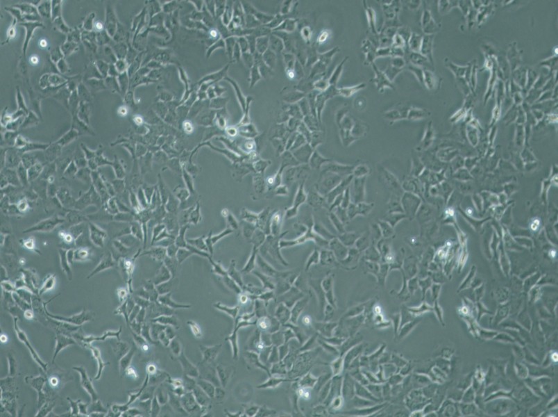 SK-OV-3 Cell Complete Medium - 3