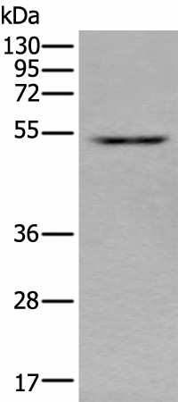 Western blot analysis of HEPG2 cell lysate  using ZNF672 Polyclonal Antibody at dilution of 1:350