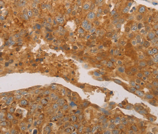PRDX3 Polyclonal Antibody - 3