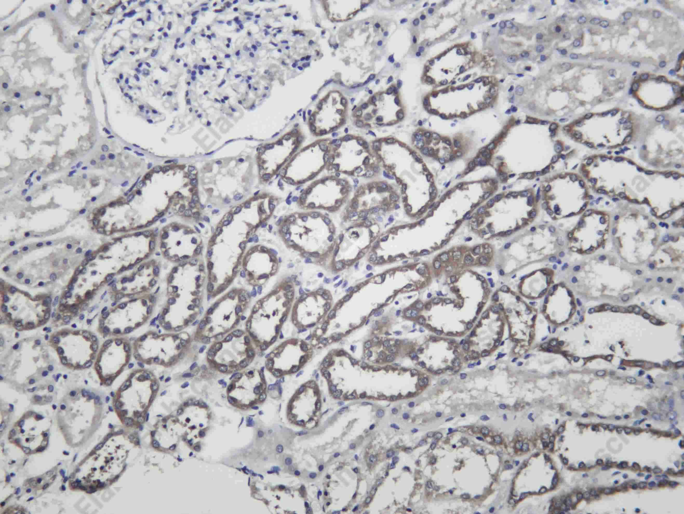 Recombinant RARβ Monoclonal Antibody - 1
