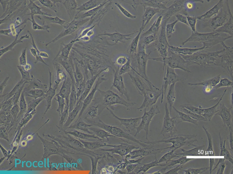Rat Trabecular Meshwork Cell Complete Medium - 5