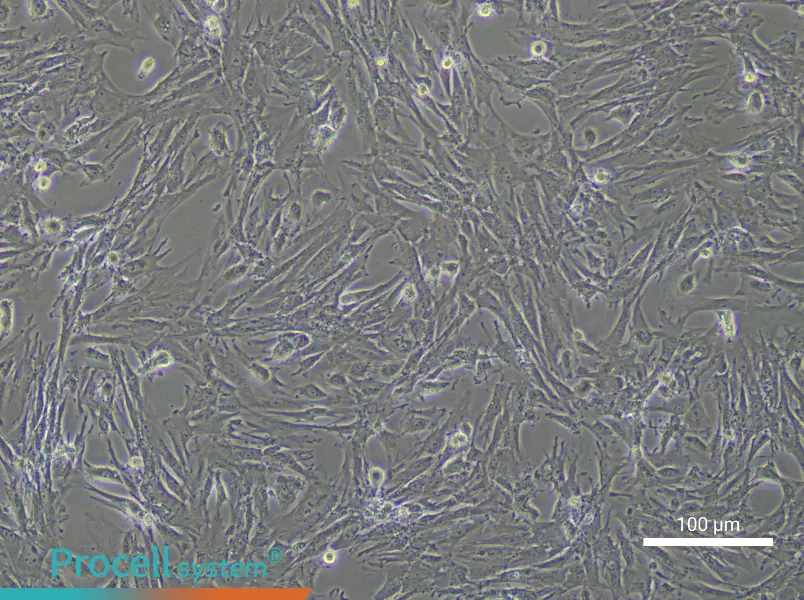 Mouse Pulmonary Artery Smooth Muscle Cell Complete Medium - 3