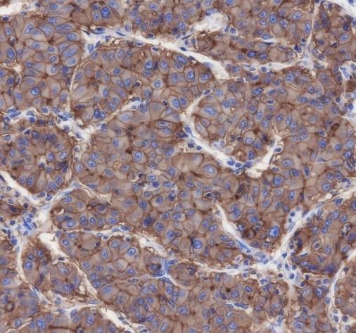 Recombinant Scavenging Receptor SR-BI Monoclonal Antibody - 3