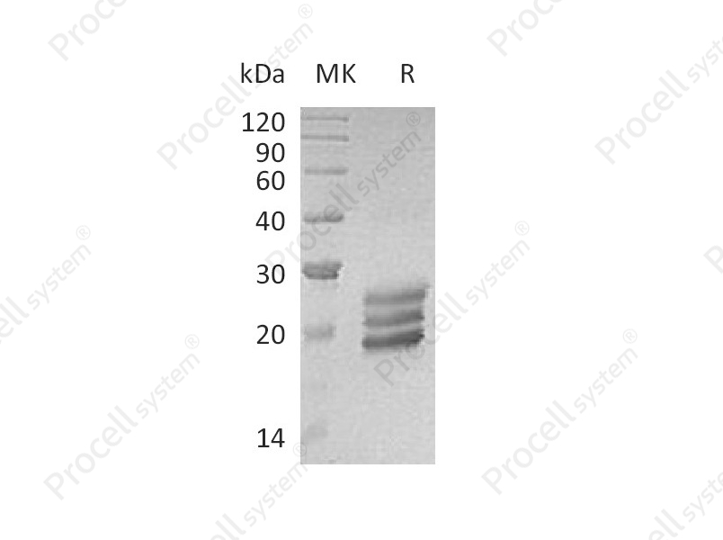 IL-25 (C-6His), Human, Recombinant
